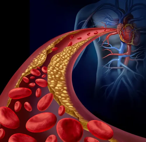 Cholesterol Disorders Treatment service image