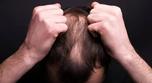 Hair Problem service image