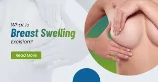 Swelling Excision service image