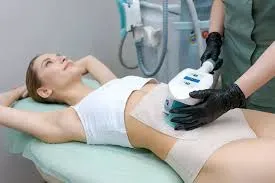 Cryolipolytic therapy  service image