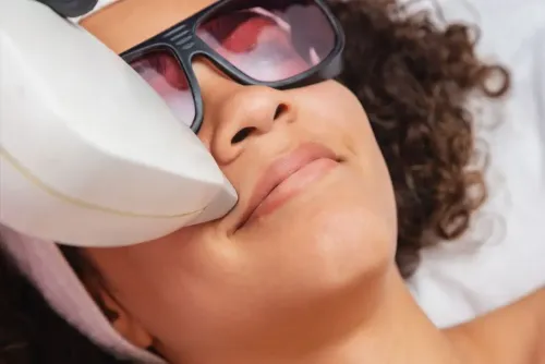 Laser Hair Reduction  service image