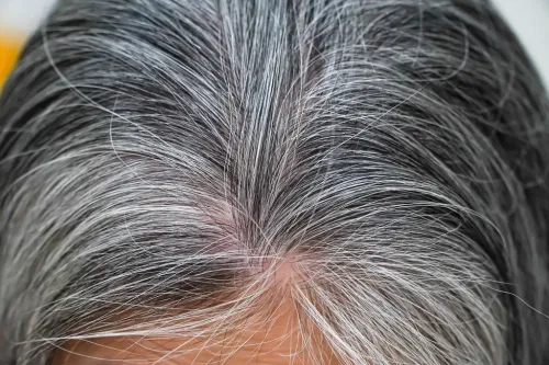 Premature greying control service image