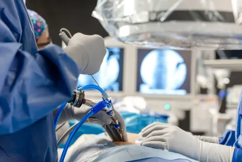Endoscopic Spine Surgery service image