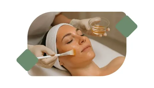 Chemical Peels service image