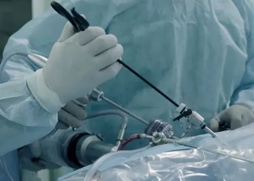 Laparoscopic Gynecology Surgery service image