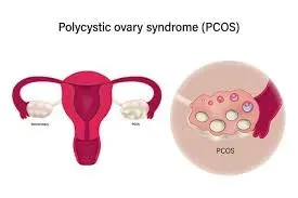 PCOS / well Women Clinic service image