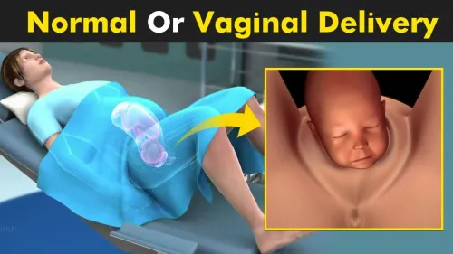 Normal Delivery (Vaginal Birth) service image