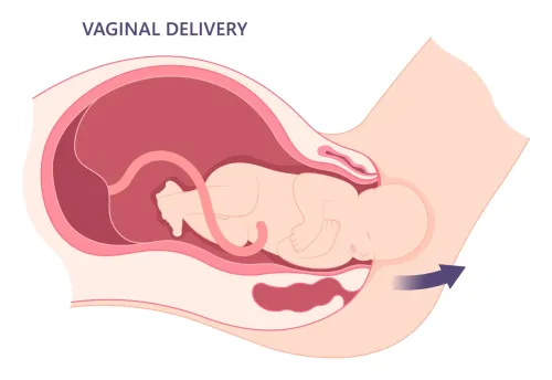 VBAC (Vaginal Birth After Cesarean) Treatment service image