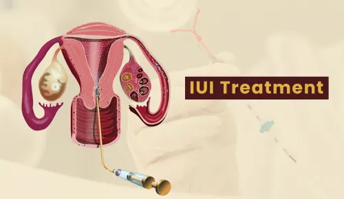 IUI (Intrauterine Insemination) Treatment service image