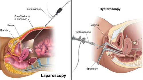 Laparoscopy & Hysteroscopy service image