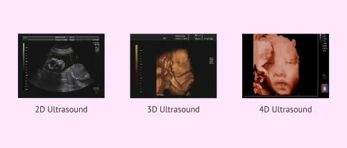 Ultrasound (2D/3D/4D) service image