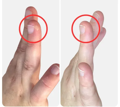 Wart removal service image