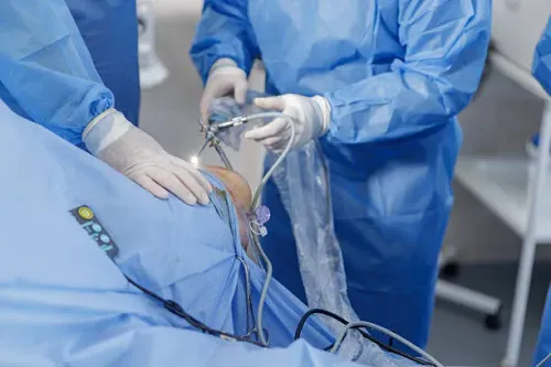Ligament and Tendon Repair service image