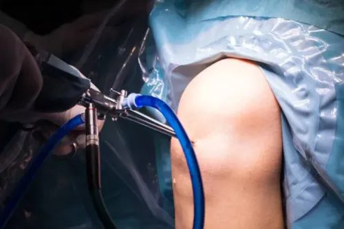 Minimally Invasive Knee Correction service image