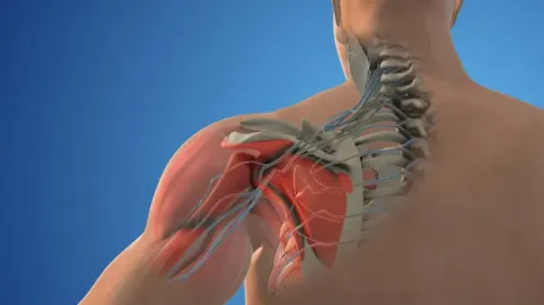 Shoulder Impingement Surgery service image