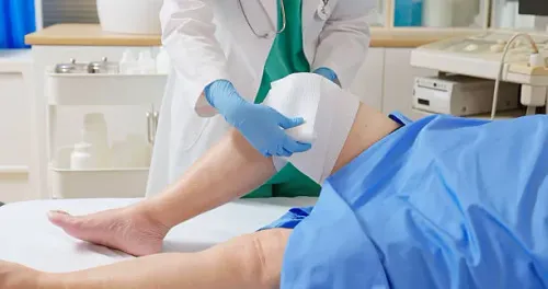 Knee Replacement Surgery service image