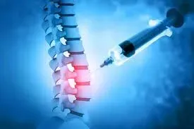Spinal Injections for Back & Neck Pain Relief service image