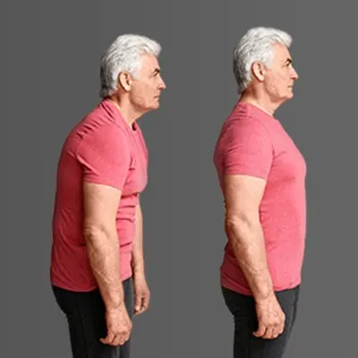 Posture & Lifestyle Optimization service image