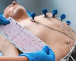 ECG Test service image