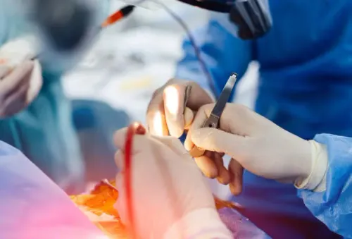 Endoscopic Brain Surgery service image