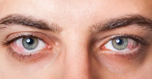 Dry Eye Treatment in Thane service image