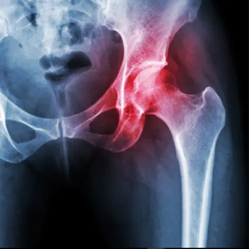 AVN Non-Surgical Regenerative Program Treatment service image