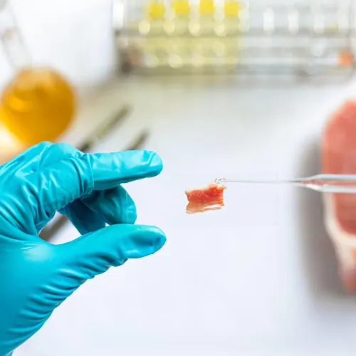 Bone Marrow Concentrate Treatment service image