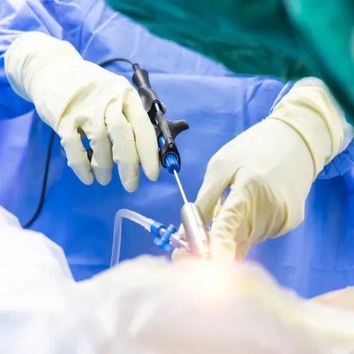 Spine Endoscopy Treatment service image