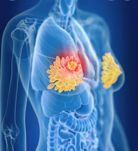 Breast Surgeon in Viman Nagar, Kharadi, Vishrantwadi, Pune service image