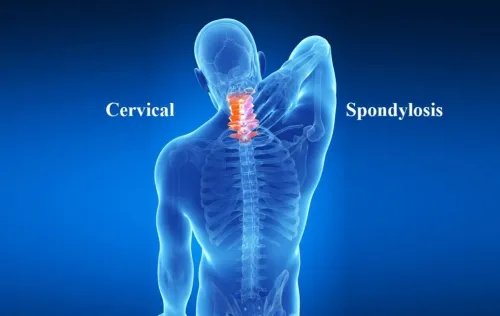 Cervical spondylosis service image