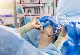 Arthroscopy and Sports Medicine Treatment service image