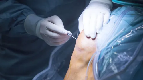 Accident and Trauma Surgery service image