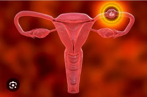 Ectopic pregnancy  service image