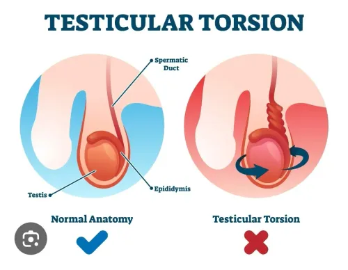 Cystectomy  service image