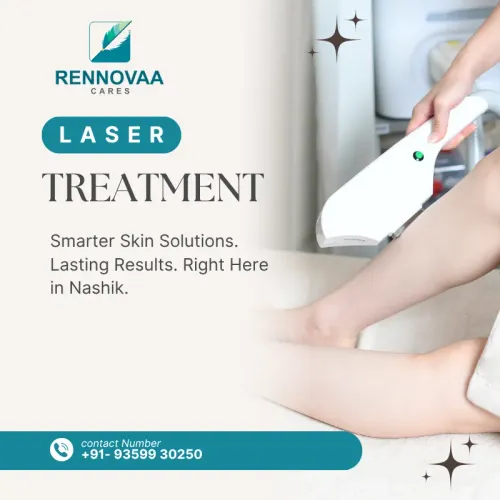 Laser Treatments service image