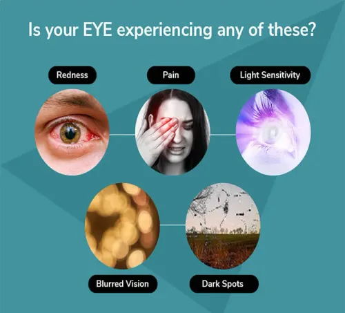 Uveitis Management at Thane service image