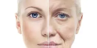 Anti-Ageing Treatment service image
