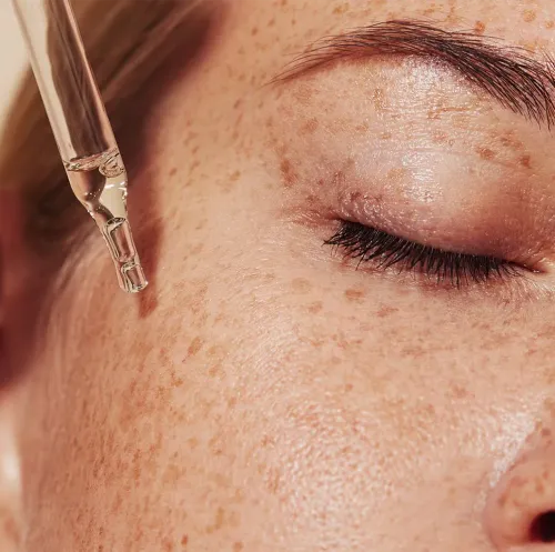 Anti-Pigmentation Treatment service image