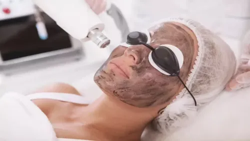 Carbon Magic Peel Treatment service image
