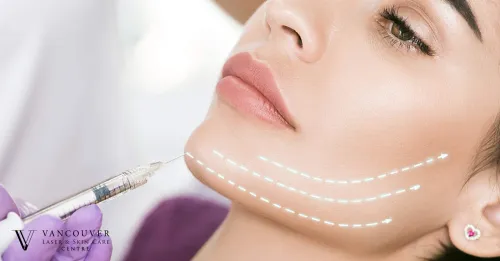 Non-Surgical Facelift Treatment service image