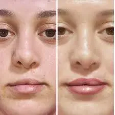 Medical Micropigmentation service image