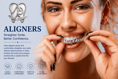 Aligners service image