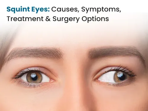  Squint Treatment service image