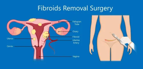  Uterus Removal Surgery service image