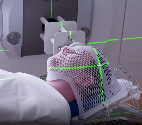 Stereotactic Radiosurgery ( SRS) service image