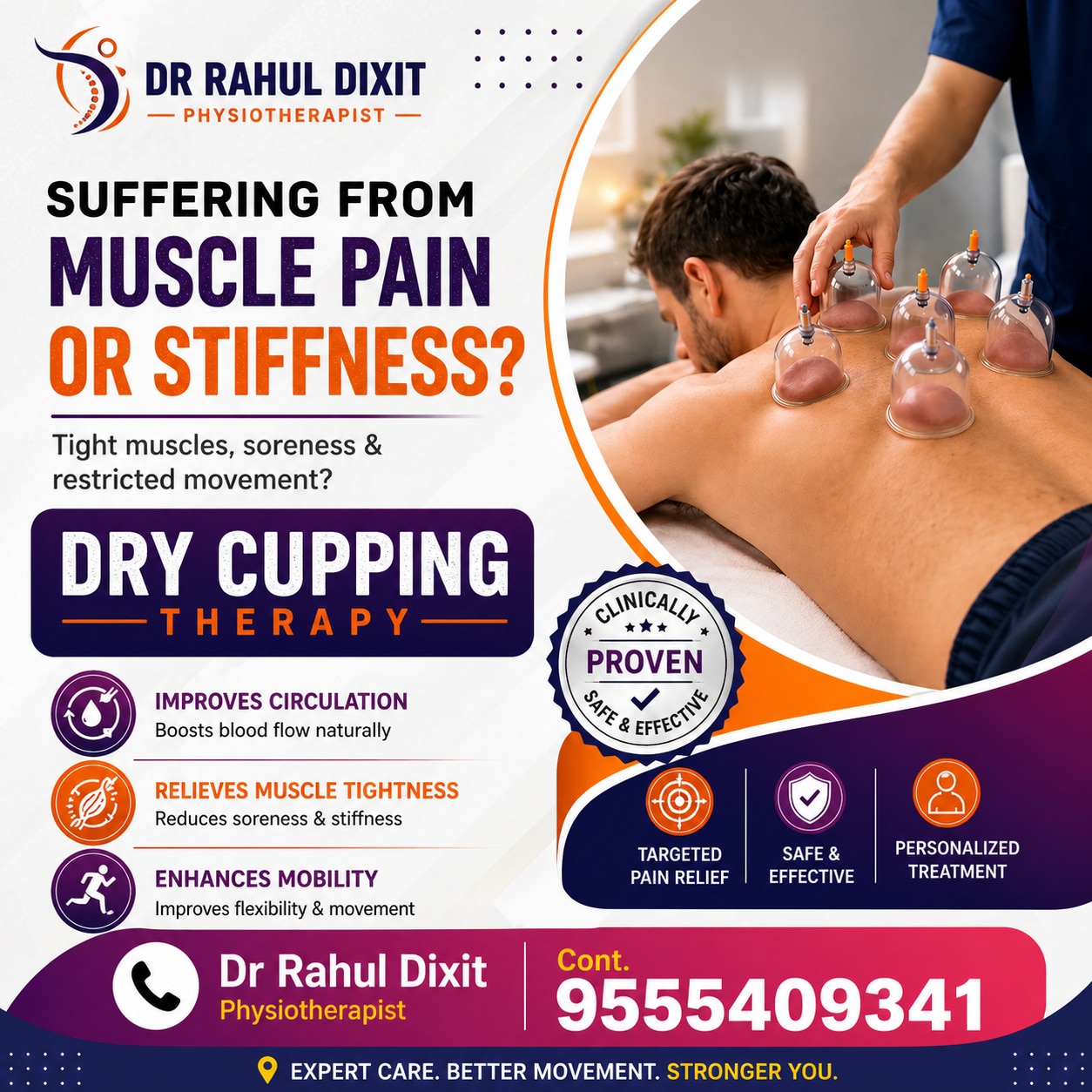 Cupping th
