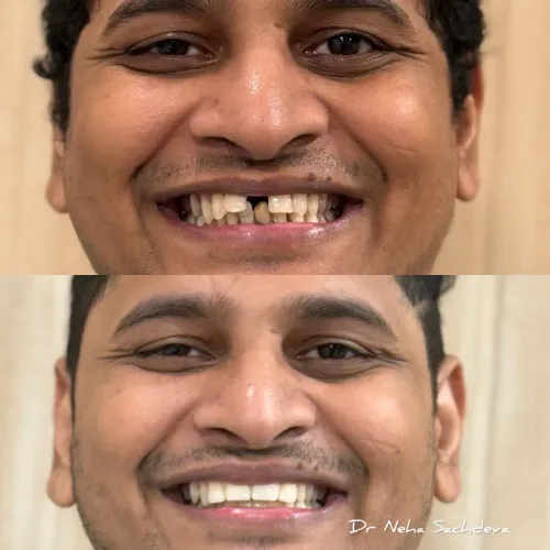 Prosthodontics service image