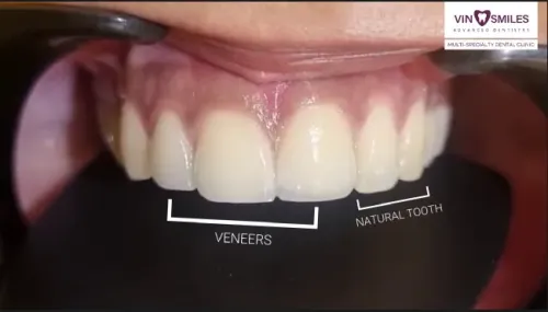 Conservative Dentistry service image