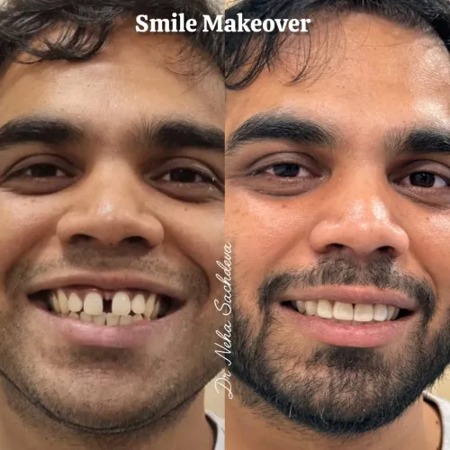 Smile Makeover service image