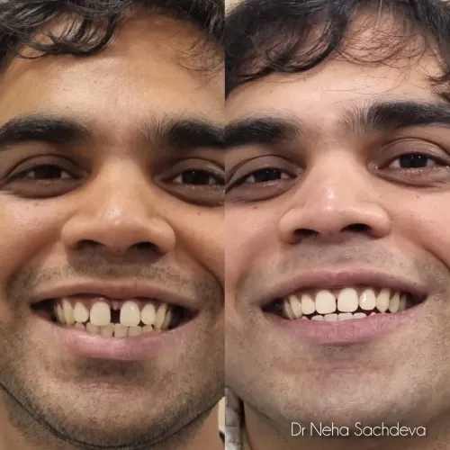 Invisalign  service image